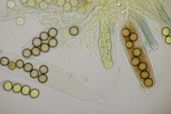 Ascobolus brassicae