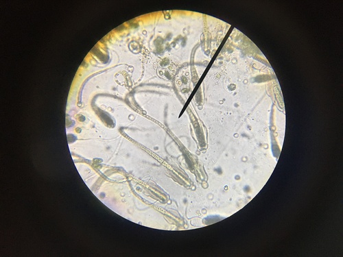 Gloeotrichia natans observed 2021-03-03