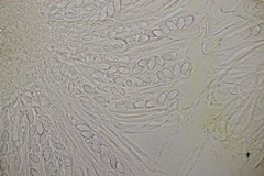 Ascobolus crenulatus