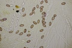 Ascobolus crenulatus