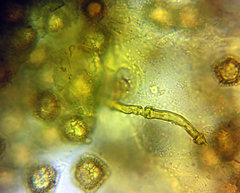 Oligonema schweinitzii