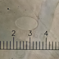 Melanohalea septentrionalis