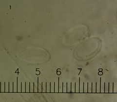 Melanohalea septentrionalis