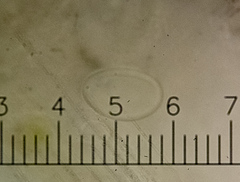 Melanohalea septentrionalis