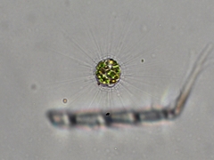 Acanthocystis