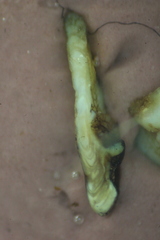 Catostomus commersonii