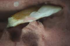 Dorosoma cepedianum