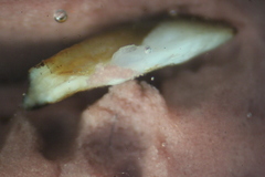 Dorosoma cepedianum