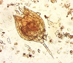 Lecane quadridentata