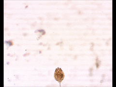 Lecane quadridentata