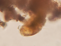 Echiniscidae