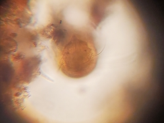 Echiniscidae