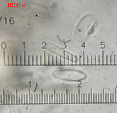 Lachnellula occidentalis