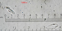 Lachnellula occidentalis