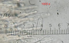 Lachnellula occidentalis