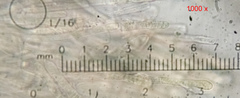 Lachnellula occidentalis