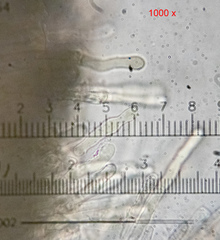 Lachnellula occidentalis