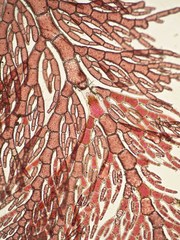 Callithamnion biseriatum