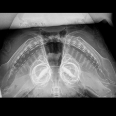 Carcharhinus amboinensis