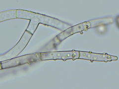 Botryobasidium conspersum