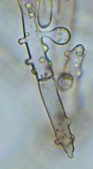 Botryobasidium conspersum