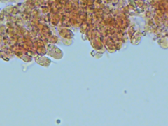 Phlebiella