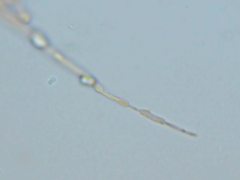Phlebiella