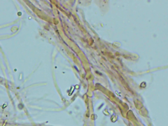 Phlebiella
