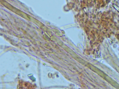 Phlebiella