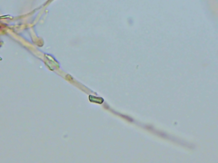 Phlebiella
