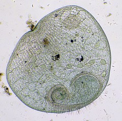 Stentor coeruleus
