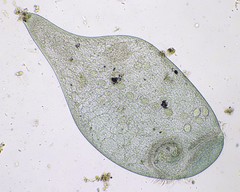 Stentor coeruleus