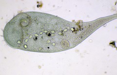 Stentor coeruleus