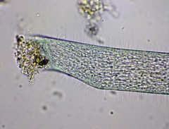 Stentor coeruleus