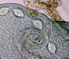 Stentor coeruleus