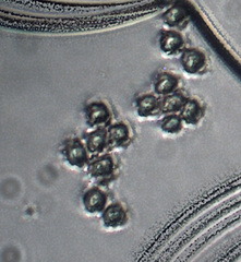 Hydnellum suaveolens