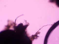 Rosellinia subiculata