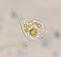 Strobilidium