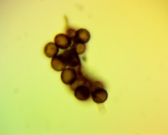 Didymium melanospermum