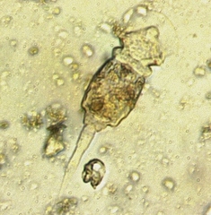Squatinella