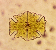 Micrasterias americana