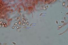 Rossbeevera vittatispora