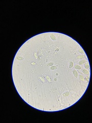 Chrysomphalina grossula