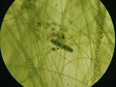 Mesotaeniaceae