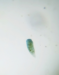 Stentor coeruleus