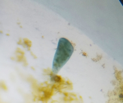 Stentor coeruleus