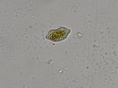 Surirella