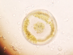 Coscinodiscophycidae