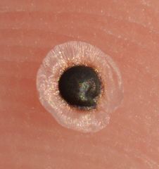Spergula pentandra