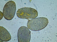 Colchicum bulbocodium versicolor